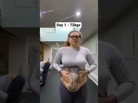 Review Of Eleone Wellness Apple Cider Vinegar Gummies For Weight Loss Gut Health Usa Brand