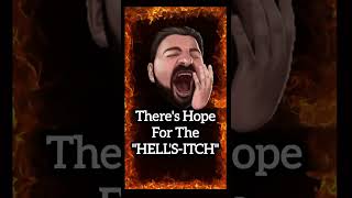 😫What to Do for SEVERE  ITCHING🔥HELLS-Itch SUNBURN TANNING Bed