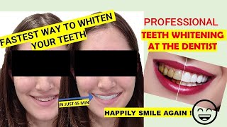 Teeth Whitening At The Dentist | Fastest Way To Whiten Your Teeth In English 2021