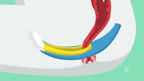 Pelvic Floor Training