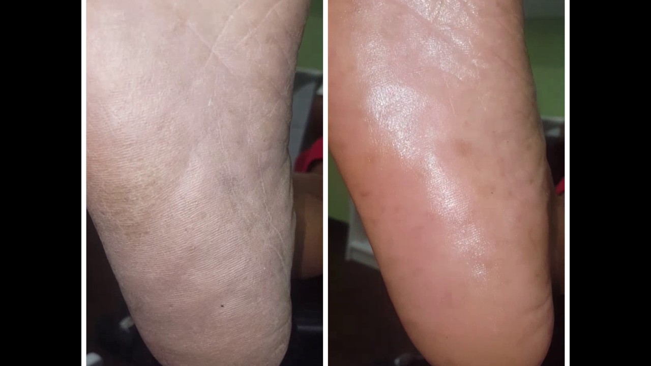 vidstitch video 1486997080615