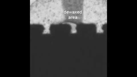 Tissue Lithography: Microscale Dewaxing to Enable Retrospective Studies on FFPE Tissue Sections