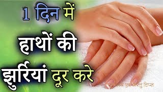 हाथों की झुर्रियां दूर करके हाथो को Soft and shiny बनाये | hathon ki jhuriyan kaise dur kare screenshot 4