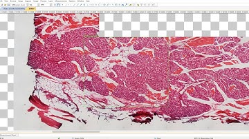 BioStitch: live stitching demo, how to convert a microscope to digital slide scanner