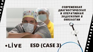:       . Live  : ESD