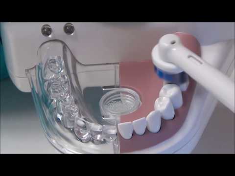 Videó: 3 módszer a teafoltok eltávolítására a fogakon