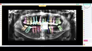 Checkdent - Künstliche Intelligenz?