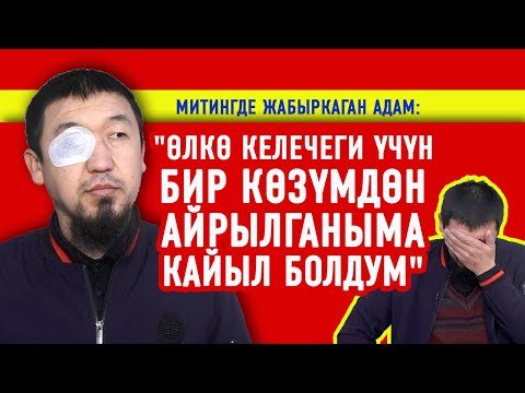 "Өлкө келечеги үчүн бир көзүмдөн айрылганыма кайыл болдум" дейт митингде жабыркаган адам