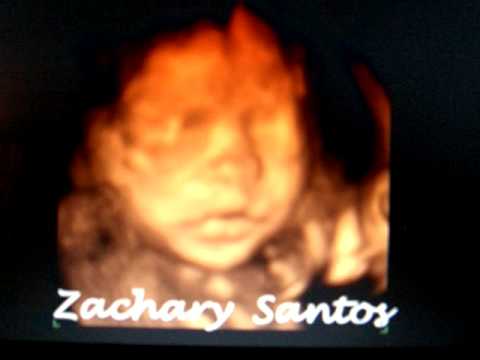 4d ultrasound of baby Zachary Santos at 24 weeks- asleep