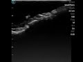 Ultrasound Scanning Results of Rat Phantom