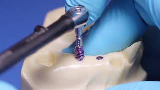 Straumann® BLX Implant System  Healed Sites