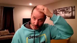 FUE Explained and Testimonial