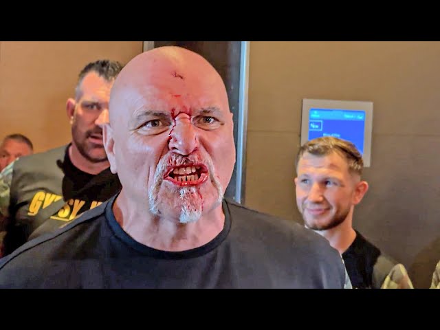 WILD! BIG JOHN FURY LEFT BLEEDING after Tyson Fury u0026 Oleksandr Usyk team ALTERCATION class=