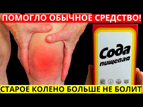 БОЛЬ В КОЛЕНЯХ УШЛА за 2 часа СРЕДСТВО от Болей в суставах! Яблочный уксус, лавровый лист, сода...