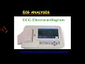 ECG ANALYSIS