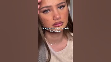 5 SIGNS YOUR ACNE IS HORMONAL! 🚨 (Don’t Ignore This!) #skincare #shorts #viralvideo #trending #fyp