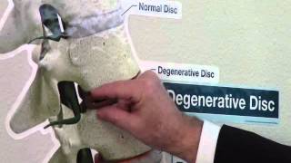 Getting to Know Your Spine Condition with Dr. Dennis Smith