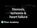Stenosis, ischemia and heart failure | Miscellaneous | Heatlh & Medicine | Khan Academy