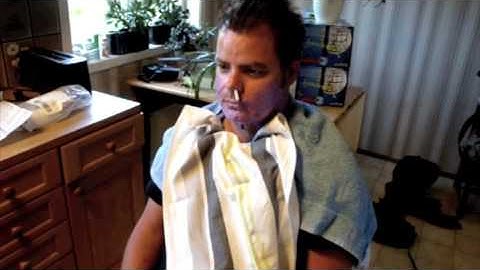 Casting a face using Alginate