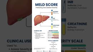 MELD Score Explained | End-Stage Liver Disease Severity, Prognosis &amp; Liver Transplant Priority