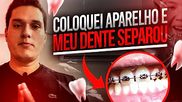Porque os meus dentes da frente estão se separando?