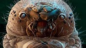 The Demodex Mite Is Still Alive! - YouTube