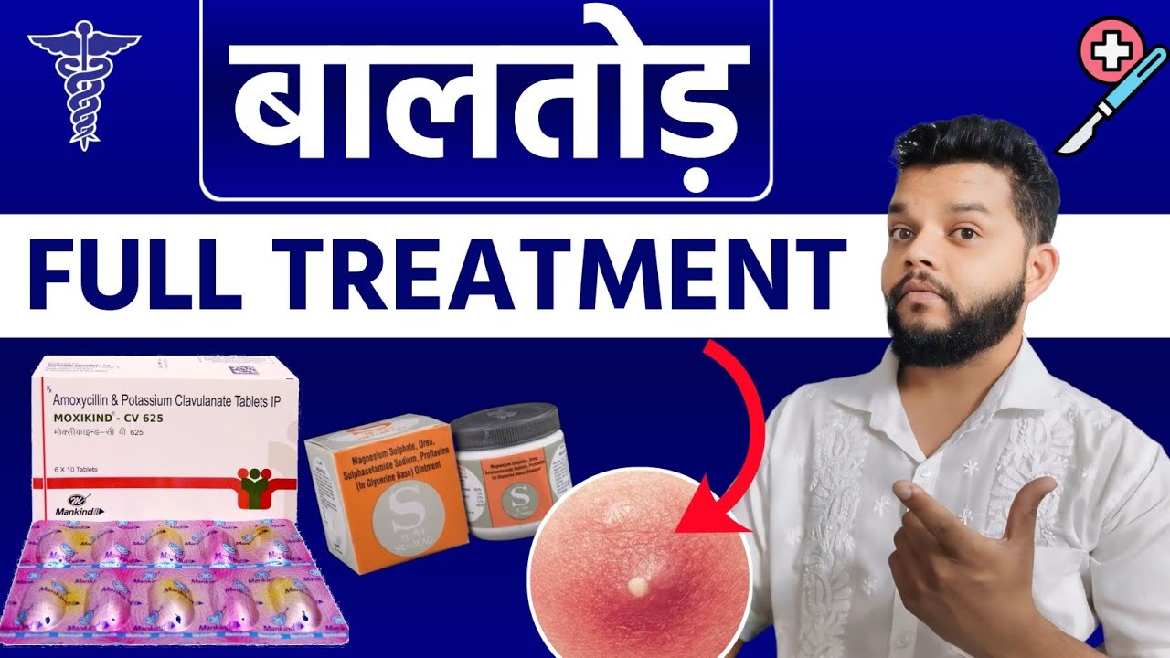 बालतोड़ का एलोपैथिक इलाज 🔥 Treatment Of Boils In Allopathy