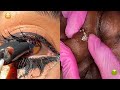 Most Extreme Beauty Treatments 2021 Best Smart and Helpful Beauty Hacks | Virtual Beauty