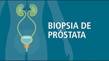 ¿Cuál es el inconveniente de una biopsia de próstata?