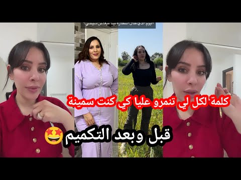 كيف أصبحت نينا قبل وبعد عملية التكميم
