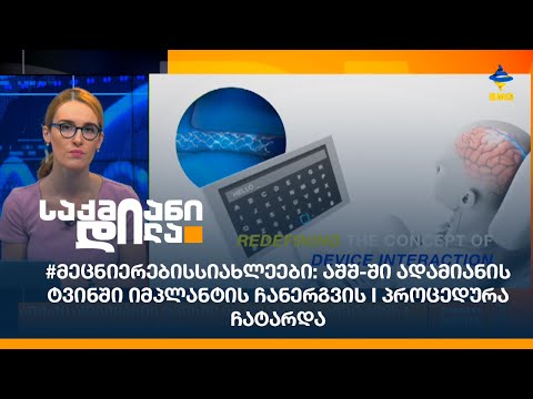 #მეცნიერებისსიახლეები: აშშ-ში ადამიანის ტვინში იმპლანტის ჩანერგვის I პროცედურა ჩატარდა