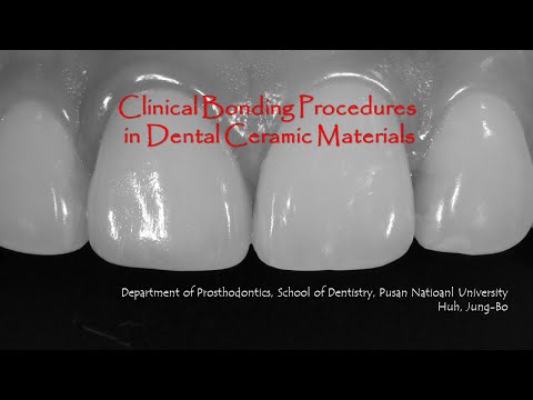 치과의사와 치과기공사를 위한 Dental Ceramic Bonding 원리