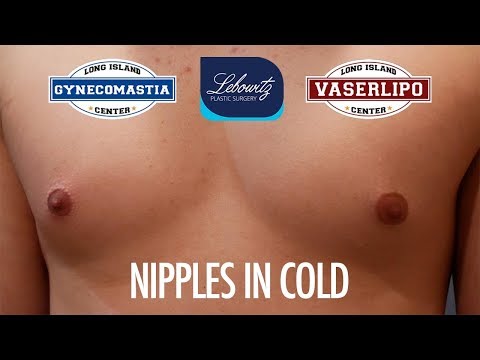 MY NIPPLES LOOK BETTER WHEN I'M COLD ❄️  Dr. Lebowitz