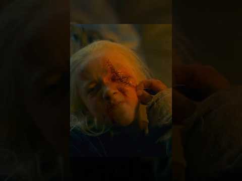 Молодой принц потерял глаз… #сериал #домдракона #houseofdragons