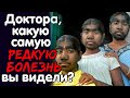 Врачи, Какую Самую Редкую Болезнь Вы Видели на Работе?