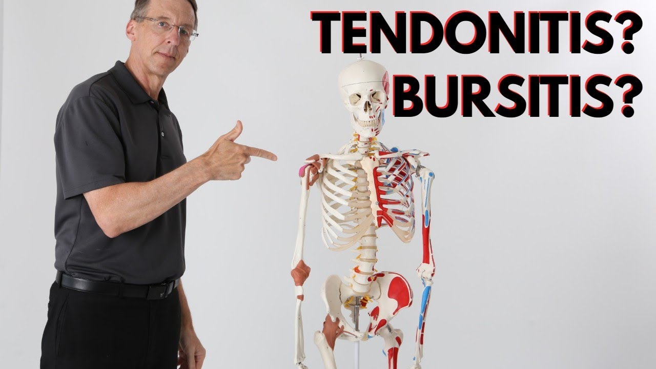 What Is Causing Your Shoulder Pain? Tendonitis? Bursitis? How To Know?