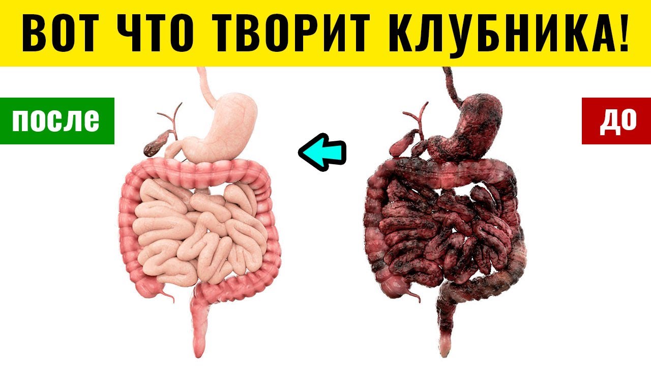 Что будет если съесть 5 кг клубники? Клубника: польза и вред для ...