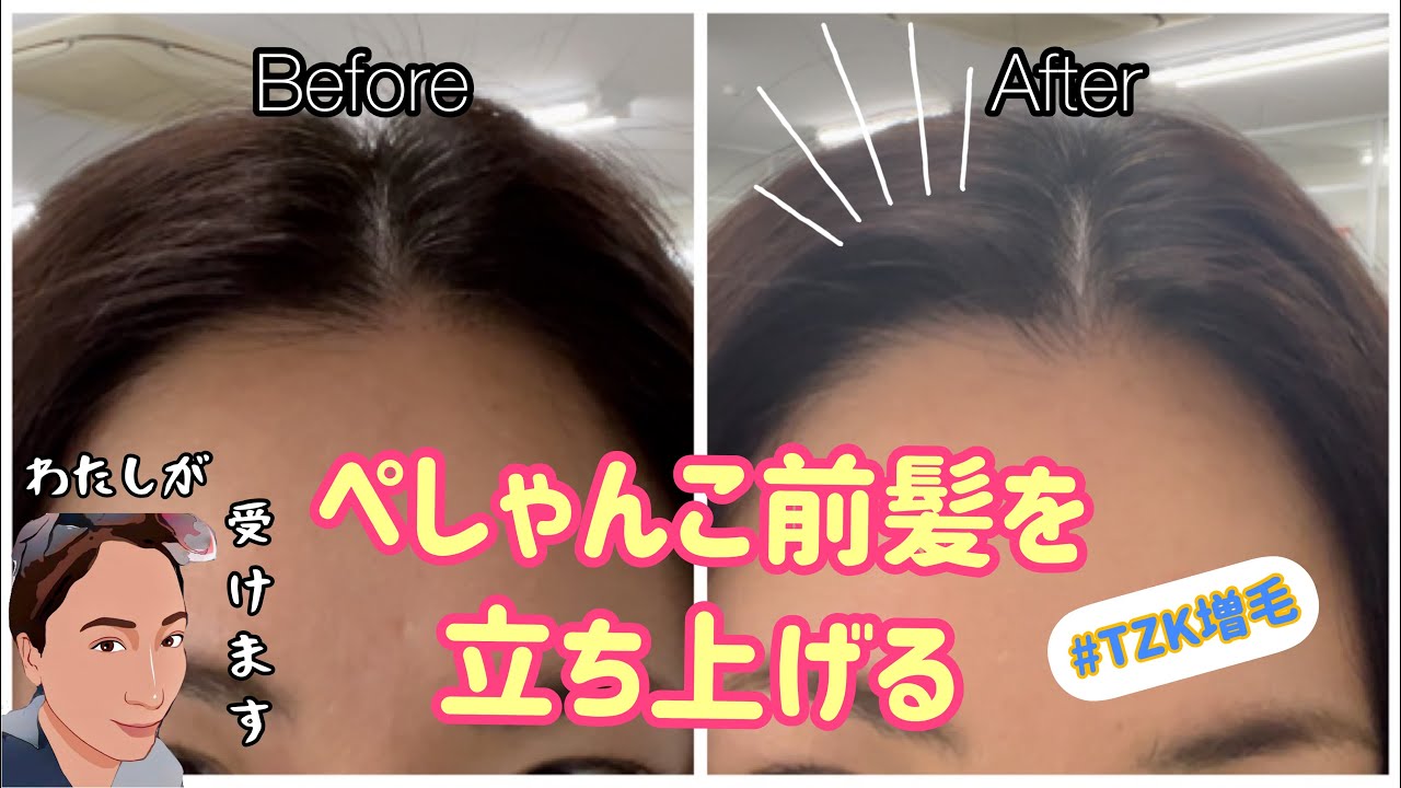 増毛例17 ぺちゃんこ前髪を立ち上がらせる Tzk増毛の増毛エクステ Youtube