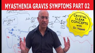 Myasthenia Gravis | Symptoms and Treatment | Part 2