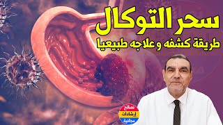 طريقة تكشف إذا كنت مصابا بالتوكال وهذه علاماته وعلاجه مع الدكتور محمد الفايد