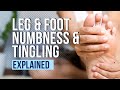 Leg and foot numbness and tingling explained