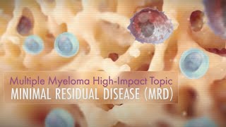 Minimal Residual Disease (MRD) | High Impact Topic (HIT)