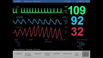 Heart Rate Monitor Templates for After Effects