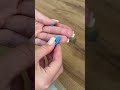 Прокол без боли — с правильными ланцетами из ДиаМарки😉 Выбирайте комфорт каждый день!