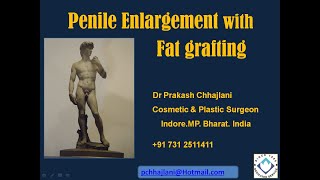 Penis size enhancement by fat grafting for a robust looking organ.A confidence booster surgery.
