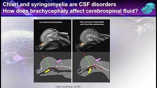 Syringomyelia from the expert  the filling mechanism