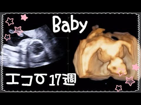 エコー動画 妊娠17週 お腹の赤ちゃん 5ヶ月 Echo Medical Examination Youtube