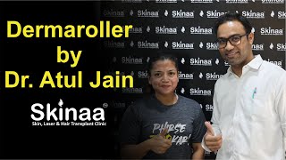 Dermaroller Treatment By Dr Atul Jain Skinaa Clinic