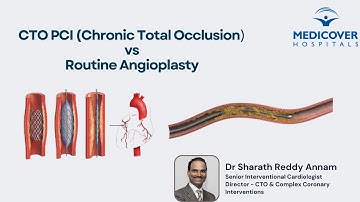 CTO PCI vs Routine Angioplasty | CTO PCI How It Differs from Routine Angioplasty Dr. Sharath Reddy