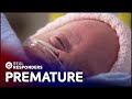 Premature Baby Needs Immediate Brain Surgery | Temple Street | Real Responders